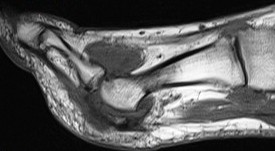 Figure 3 for case Gout arthritis ( RID3567 )